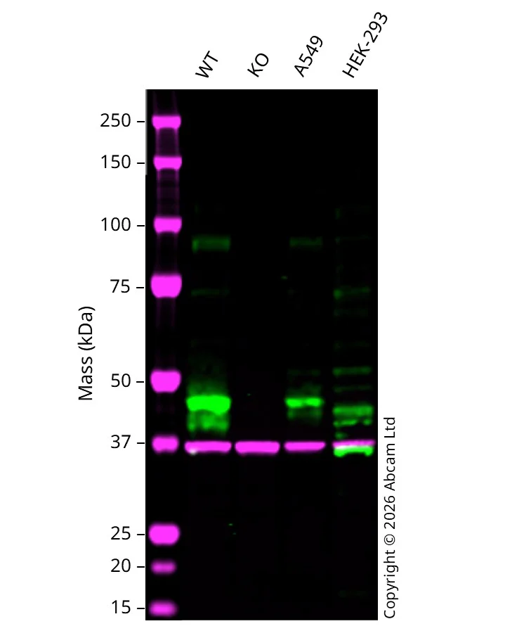 Western blot - Anti-PAI1 antibody [EPR21850-82] (AB222754)
