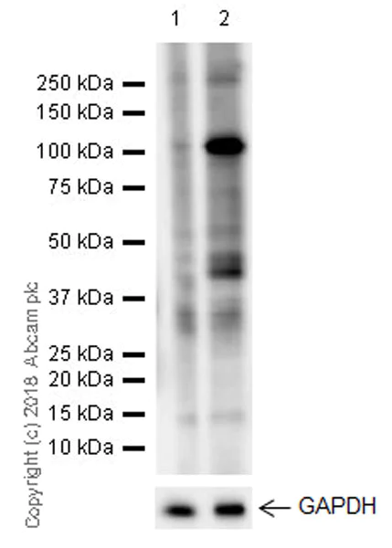 Western blot - Anti-PAI1 antibody [EPR21850-82] (AB222754)