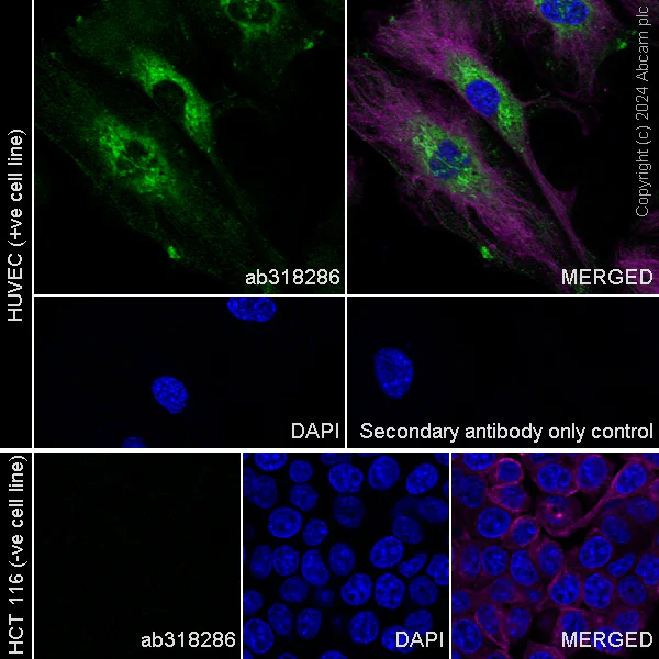 Immunocytochemistry/ Immunofluorescence - Anti-PAI1 antibody [RM1209] (AB318286)