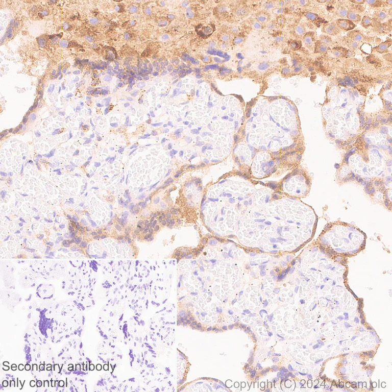 Immunohistochemistry (Formalin/PFA-fixed paraffin-embedded sections) - Anti-PAI1 antibody [RM1209] (AB318286)