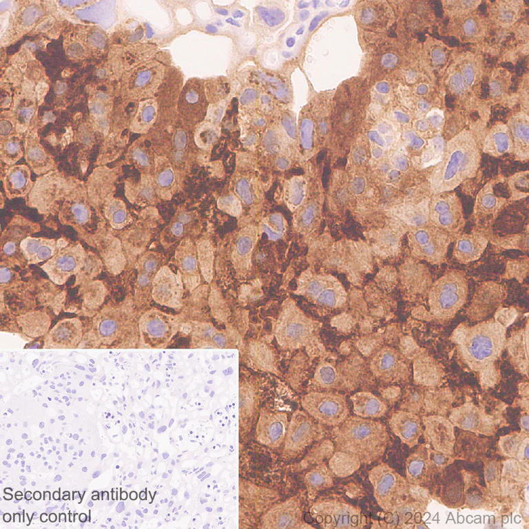 Immunohistochemistry (Formalin/PFA-fixed paraffin-embedded sections) - Anti-PAI1 antibody [RM1209] (AB318286)