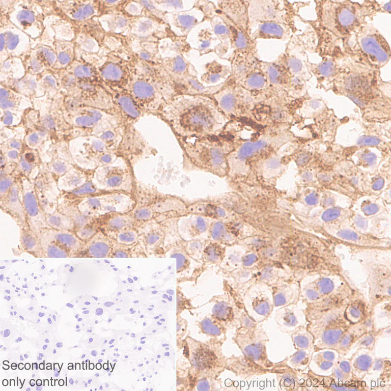 Immunohistochemistry (Formalin/PFA-fixed paraffin-embedded sections) - Anti-PAI1 antibody [RM1209] (AB318286)