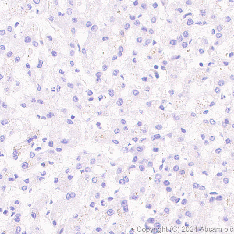 Immunohistochemistry (Formalin/PFA-fixed paraffin-embedded sections) - Anti-PAI1 antibody [RM1209] (AB318286)
