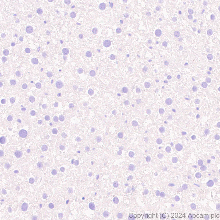 Immunohistochemistry (Formalin/PFA-fixed paraffin-embedded sections) - Anti-PAI1 antibody [RM1209] (AB318286)