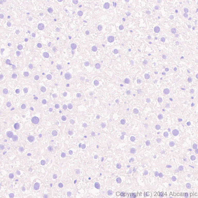 Immunohistochemistry (Formalin/PFA-fixed paraffin-embedded sections) - Anti-PAI1 antibody [RM1209] (AB318286)