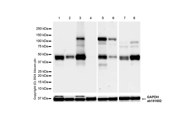 Western blot - Anti-PAI1 antibody [RM1209] (AB318286)