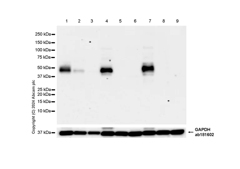 Western blot - Anti-PAI1 antibody [RM1209] (AB318286)