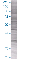 PAI1 overexpression 293T lysate (whole cell)