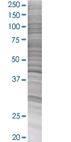 SDS-PAGE - PAI1 overexpression 293T lysate (whole cell) (AB94070)