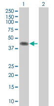 Western blot - PAI1 overexpression 293T lysate (whole cell) (AB94070)