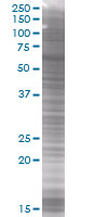 PAI1 overexpression 293T lysate (whole cell)