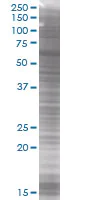 SDS-PAGE - PAI1 overexpression 293T lysate (whole cell) (AB94071)