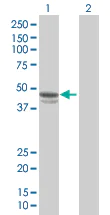 Western blot - PAI1 overexpression 293T lysate (whole cell) (AB94071)