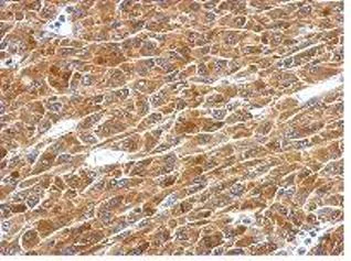 Immunohistochemistry (Formalin/PFA-fixed paraffin-embedded sections) - Anti-PAICS/PAIS antibody (AB151472)