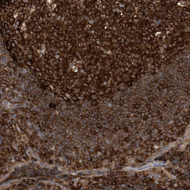 Immunohistochemistry (Formalin/PFA-fixed paraffin-embedded sections) - Anti-PAICS/PAIS antibody (AB224155)
