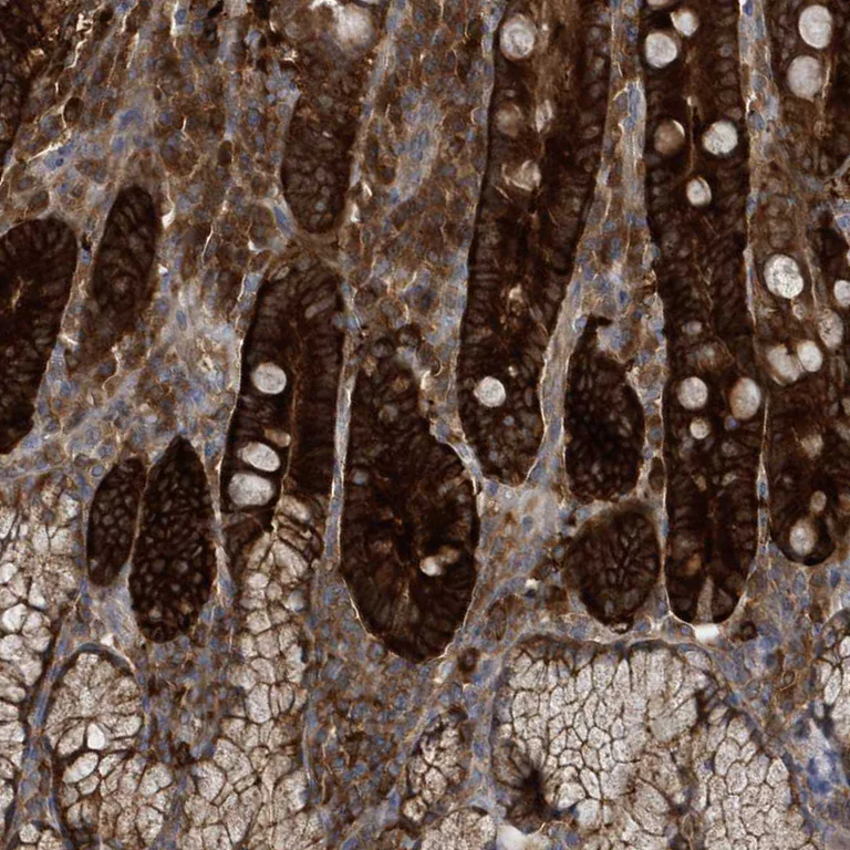 Immunohistochemistry (Formalin/PFA-fixed paraffin-embedded sections) - Anti-PAICS/PAIS antibody (AB224155)