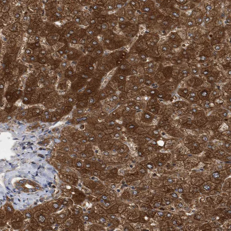 Immunohistochemistry (Formalin/PFA-fixed paraffin-embedded sections) - Anti-PAICS/PAIS antibody (AB224155)