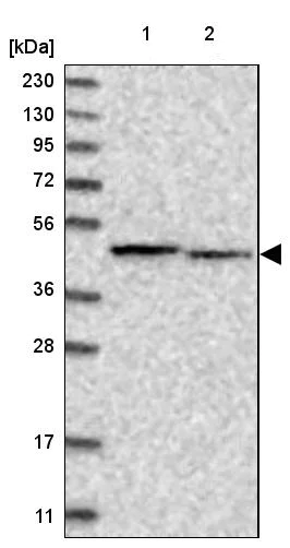 Western blot - Anti-PAICS/PAIS antibody (AB224155)