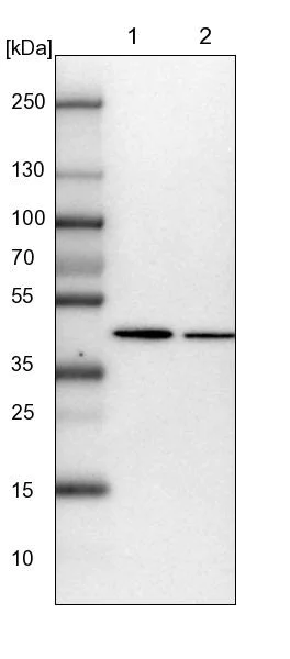 Western blot - Anti-PAICS/PAIS antibody (AB224155)
