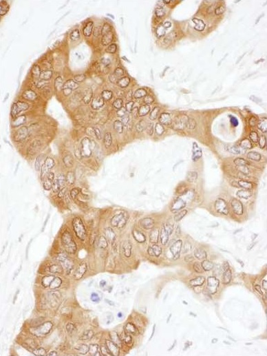Immunohistochemistry (Formalin/PFA-fixed paraffin-embedded sections) - Anti-PAICS/PAIS antibody (AB240743), expandable thumbnail