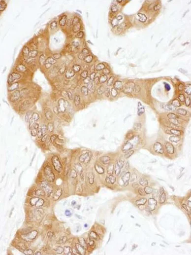 Immunohistochemistry (Formalin/PFA-fixed paraffin-embedded sections) - Anti-PAICS/PAIS antibody (AB240743)