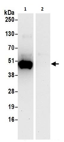 Immunoprecipitation - Anti-PAICS/PAIS antibody (AB240743), expandable thumbnail
