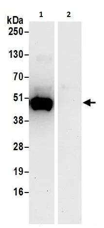 Immunoprecipitation - Anti-PAICS/PAIS antibody (AB240743)