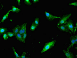 Immunocytochemistry/ Immunofluorescence - Anti-PAIP2 antibody (AB237803), expandable thumbnail