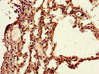 Immunohistochemistry (Formalin/PFA-fixed paraffin-embedded sections) - Anti-PAIP2 antibody (AB237803), expandable thumbnail