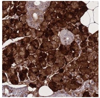 Immunohistochemistry (Formalin/PFA-fixed paraffin-embedded sections) - Anti-PAIP2B antibody (AB184774)