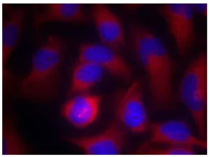 Immunocytochemistry/ Immunofluorescence - Anti-PAK1 antibody (AB131522)