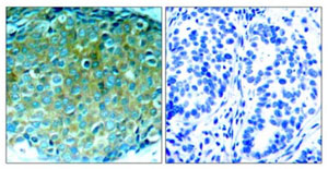 Immunohistochemistry (Formalin/PFA-fixed paraffin-embedded sections) - Anti-PAK1 antibody (AB131522)