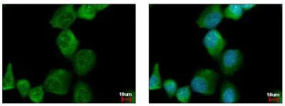 Immunocytochemistry/ Immunofluorescence - Anti-PAK1 antibody (AB183894)