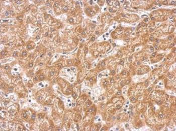 Immunohistochemistry (Formalin/PFA-fixed paraffin-embedded sections) - Anti-PAK1 antibody (AB183894), expandable thumbnail