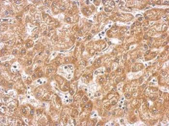 Immunohistochemistry (Formalin/PFA-fixed paraffin-embedded sections) - Anti-PAK1 antibody (AB183894)