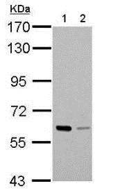 Western blot - Anti-PAK1 antibody (AB183894), expandable thumbnail