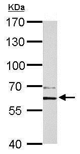 Western blot - Anti-PAK1 antibody (AB183894), expandable thumbnail