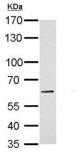 Western blot - Anti-PAK1 antibody (AB183894)