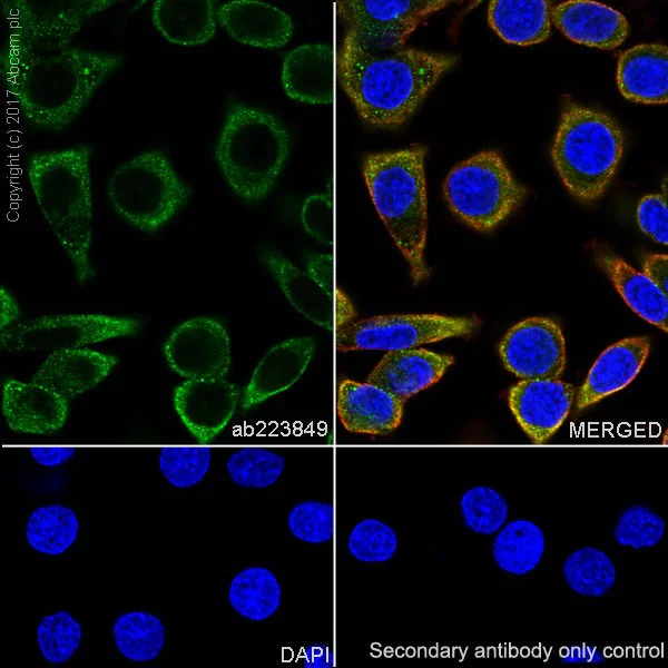 Immunocytochemistry/ Immunofluorescence - Anti-PAK1 antibody [EPR20048] (AB223849)