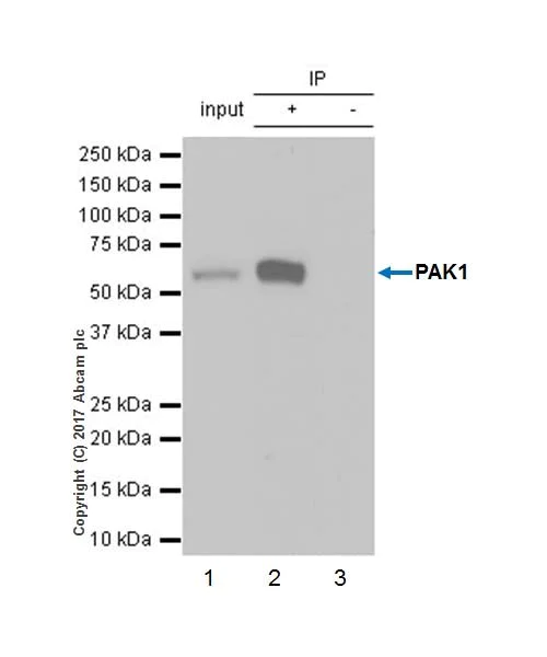 Immunoprecipitation - Anti-PAK1 antibody [EPR20048] (AB223849)
