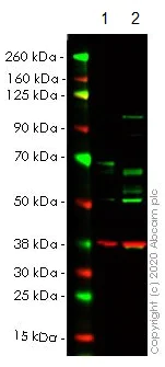 Western blot - Anti-PAK1 antibody [EPR20048] (AB223849)