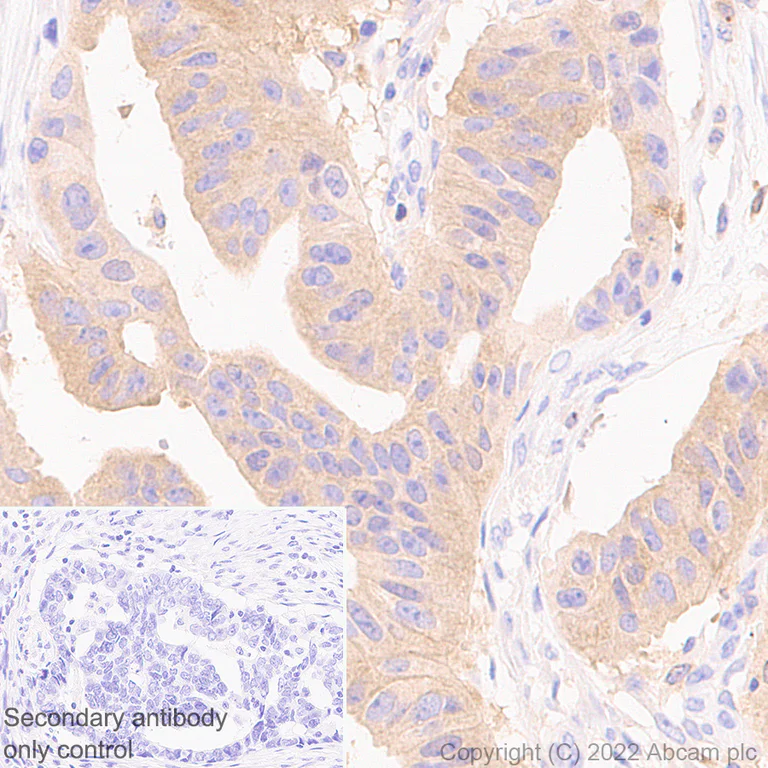 Immunohistochemistry (Formalin/PFA-fixed paraffin-embedded sections) - Anti-PAK1 antibody [EPR26067-45] (AB302506)