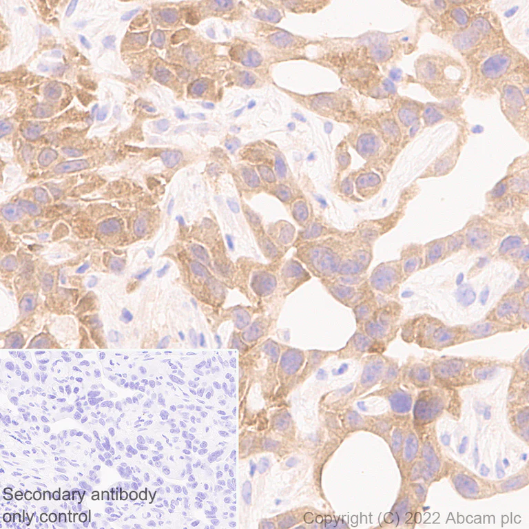 Immunohistochemistry (Formalin/PFA-fixed paraffin-embedded sections) - Anti-PAK1 antibody [EPR26067-45] (AB302506)