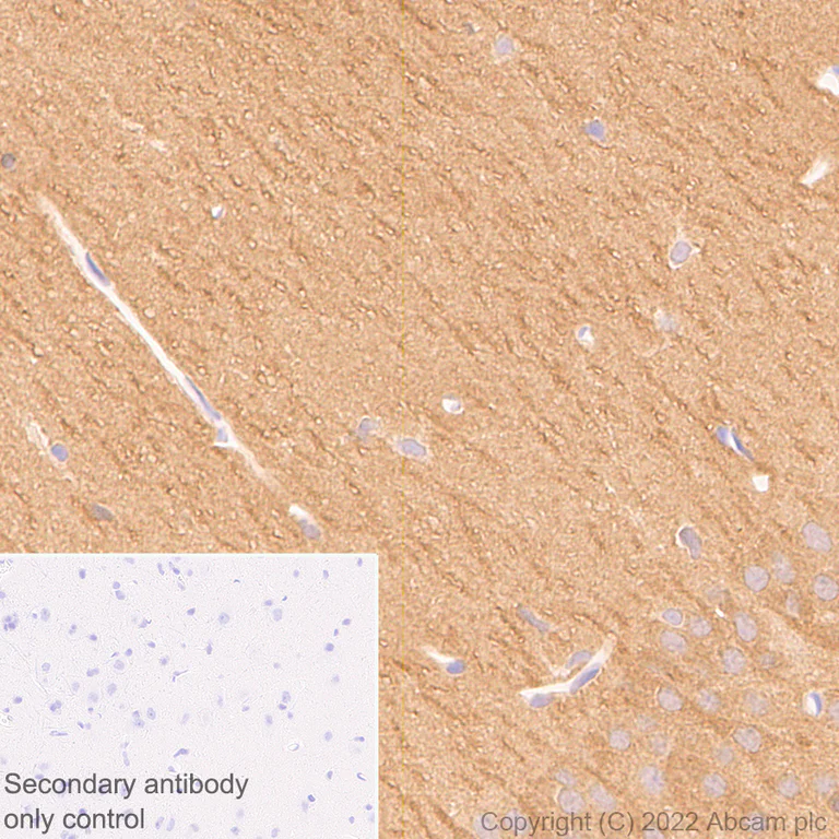Immunohistochemistry (Formalin/PFA-fixed paraffin-embedded sections) - Anti-PAK1 antibody [EPR26067-45] (AB302506)