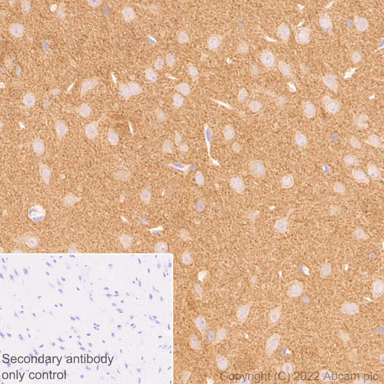 Immunohistochemistry (Formalin/PFA-fixed paraffin-embedded sections) - Anti-PAK1 antibody [EPR26067-45] (AB302506)