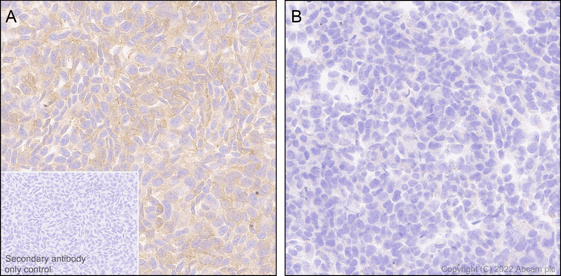 Immunohistochemistry (Formalin/PFA-fixed paraffin-embedded sections) - Anti-PAK1 antibody [EPR26067-45] (AB302506)