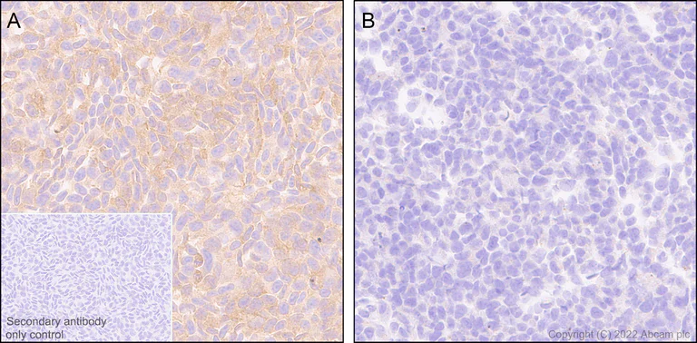 Immunohistochemistry (Formalin/PFA-fixed paraffin-embedded sections) - Anti-PAK1 antibody [EPR26067-45] (AB302506)
