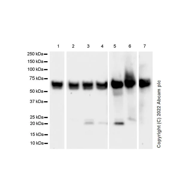 Western blot - Anti-PAK1 antibody [EPR26067-45] (AB302506)