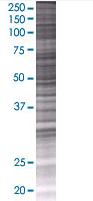 SDS-PAGE - PAK1 overexpression 293T lysate (whole cell) (AB94241), expandable thumbnail
