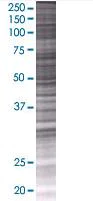 SDS-PAGE - PAK1 overexpression 293T lysate (whole cell) (AB94241)